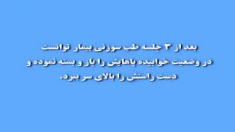 درمان ضایعه نخاعی طب سوزنی آقای سید رضا حسینی