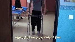 درمان ضایعه نخاعی طب سوزنی آقای قرزاد کرم پور