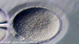 برداشت تخمک پیدایش روش تزریق اسپرم به درون سیتوپلاسم