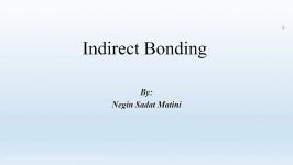 indirect bonding in orthodontics روش باندینگ غیرمستقیم