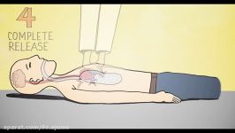 انیمیشن جالب کمک کننده درباره احیای قلبی ریوی CPR