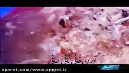 دوربین مخفی فوری فلافل ساخت سوسیس کالباس در ایران