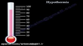 هیپوترمی  علل ، اثرات ، پیشگیری ، درمان 