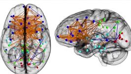 is your brain male or female