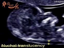 جلسه هفتم سونوگرافی دوران بارداری آزمایشگاه پردیس مشهد