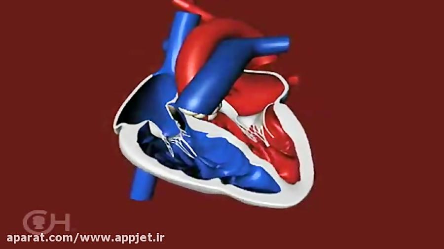 چگونه یک قلب سالم، خون را پمپ می کند؟