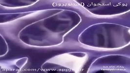 پوکی استخوان استئوپروز