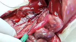 Rat Liver Perfusion Surgey  First Cut