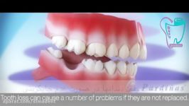 عوارض کشیدن دندان عدم جایگزینی آن  سیمادنت