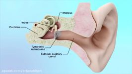 عمل جراحی اتواسکلروز otosclerosis