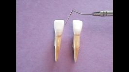 توضیح آناتومی دندان سانترال مندیبل بر روی مولاژ