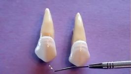 توضیح آناتومی دندان کانین ماگزیلا بر روی مولاژ