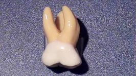 توضیح آناتومی دندان مولر اول ماگزیلا بر روی مولاژ