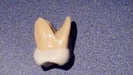 توضیح آناتومی دندان مولر دوم ماگزیلا بر روی مولاژ