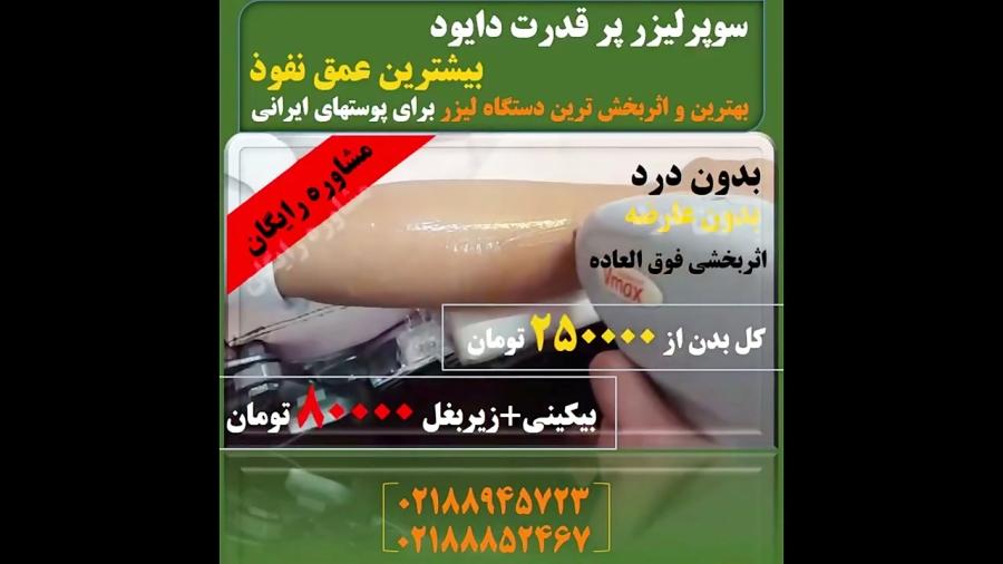 از بین بردن موهای زائد دستگاه لیزر دایود 1