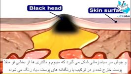 علت به وجود آمدن جوش روی پوست