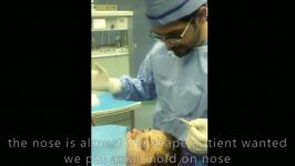 TARAH TEB CSCC PART 3  RHINOPLASTY