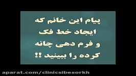 تزریق ژل چانه ، ایجاد خط فک نسل جدید فیلر هیالورونیک