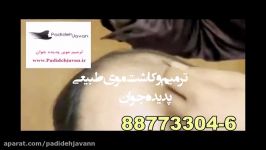 كاشت مو بدون جراحی به روش HRP