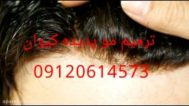 بزرگترین مرکز بافت پروتزهای مو09120614573 09198046368