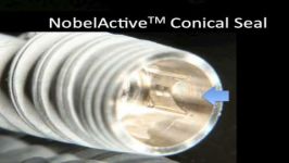 NobelActive Prosthetics