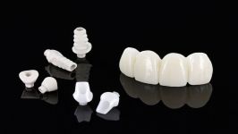 Restoring Partially Edentulous