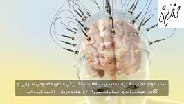 درمان وزوزگوش معرفی روش نورومدولاسیون زیرنویس فارسی