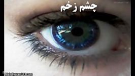 استاد رائفی پور،چشم زخم