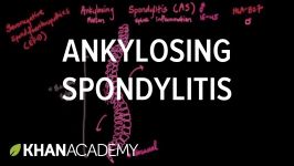  Ankylosing spondylitis  Muscular skeletal diseases  NCLEX RN  Khan Academy    اصلاح شود 