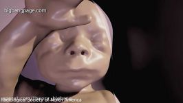 مشاهده جنین داخل رحم واقعیت مجازی
