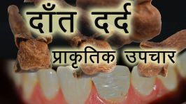 داروهای گیاهی برای درمان فوری درد دندان به روش هندی
