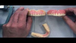 Highlighting the CADCAM Denture Process