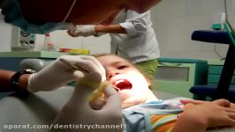 تزریق در دندانپزشکی اطفال