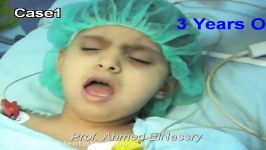 بیهوشی عمومی در دندانپزشکی اطفال