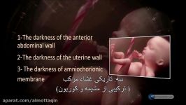 اعجاز قرآن  تاریکی های سه گانه جنین در رحم مادر