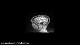 fMRI Structural Scan animated