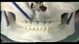 آناتومی دندان ، سانترال فک بالا ، Maxillary Incisors