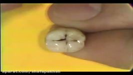 آناتومی دندان، مولار فک پایین Mandibular Molars Review