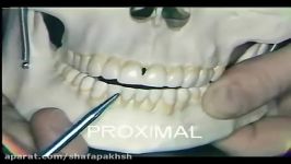 آناتومی دندان،دندانهای پیش فک پایین Mandibular Incisors