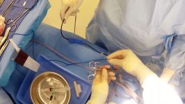 Collecting cord blood stem cells at cesarean section