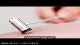 طب سوزنی درمانی موثر برای درمان ریزش مو رویش موها