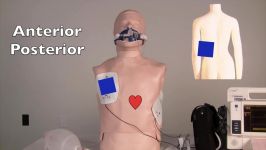 Defibrillator usage and paddle placement