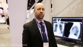 Medical Displays Tour at RSNA 2014  NEC Display Solutions