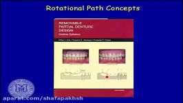 فیلم پروتز دندان Rotational path partial dentures