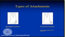 فیلم پروتز دندان Partial denture attachments