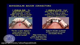 Classification and ponents of removable partial dent