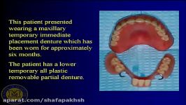 Combination cases plete and partial denture sets