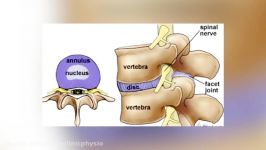 TV 73 Scoliosis and Childrens Posture اسکولیوز فرم بدن بچه ها