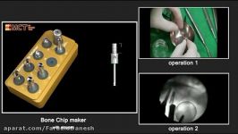 Bone Chip Maker