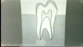آناتومی دندان اندودنتیکس،دانشگاه میشیگان